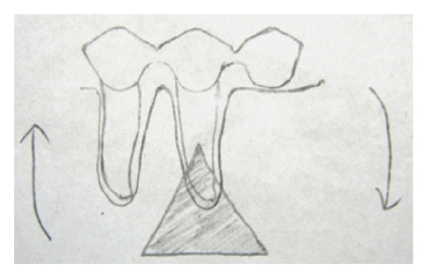 Assessment of various factors for feasibility of fixed cantilever bridge: a review study.