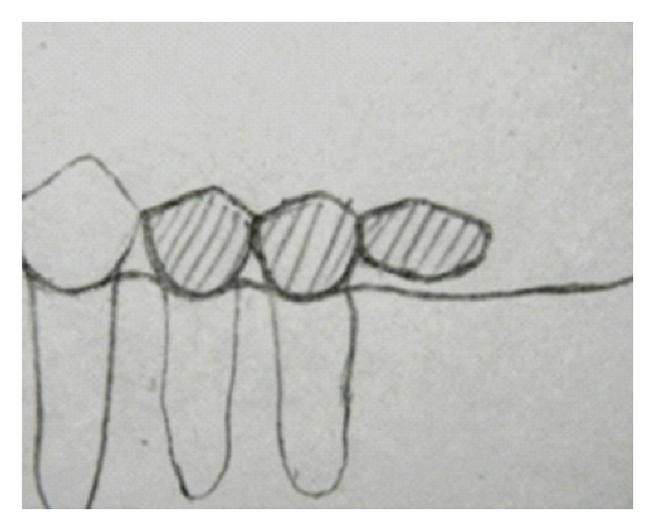 Assessment of various factors for feasibility of fixed cantilever bridge: a review study.