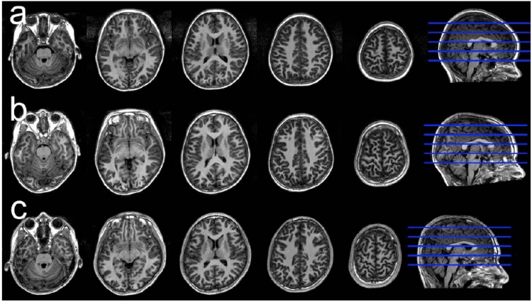 Brain development in childhood.