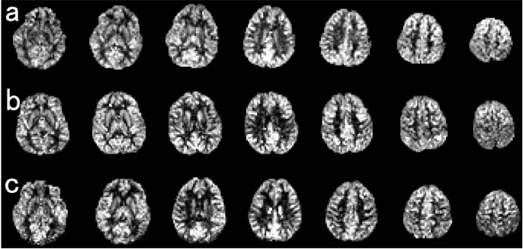 Brain development in childhood.