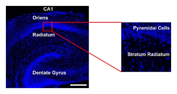 Levels of Ca(V)1.2 L-Type Ca(2+) Channels Peak in the First Two Weeks in Rat Hippocampus Whereas Ca(V)1.3 Channels Steadily Increase through Development.