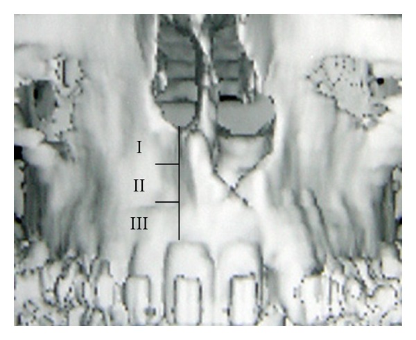 Abstract Image