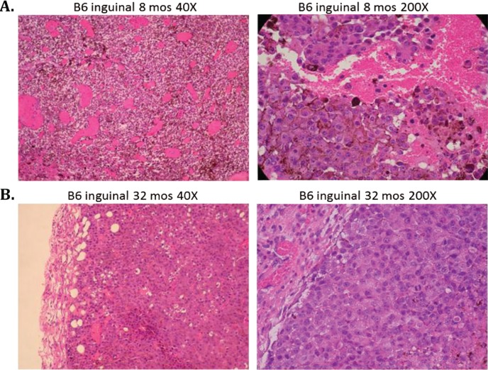 B16 melanoma tumor growth is delayed in mice in an age-dependent manner.