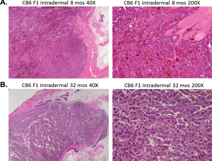 B16 melanoma tumor growth is delayed in mice in an age-dependent manner.