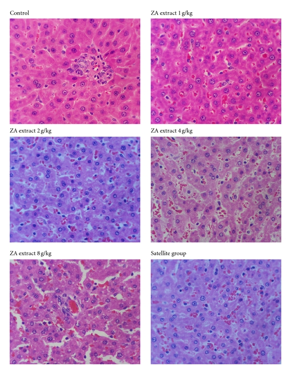 Evaluation of Acute and Chronic Toxicities of the Water Extract from Ziziphus attopensis Pierre.