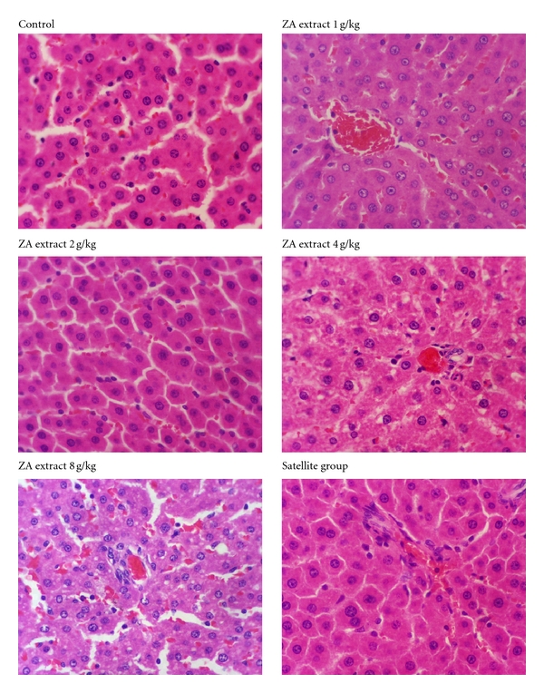 Evaluation of Acute and Chronic Toxicities of the Water Extract from Ziziphus attopensis Pierre.