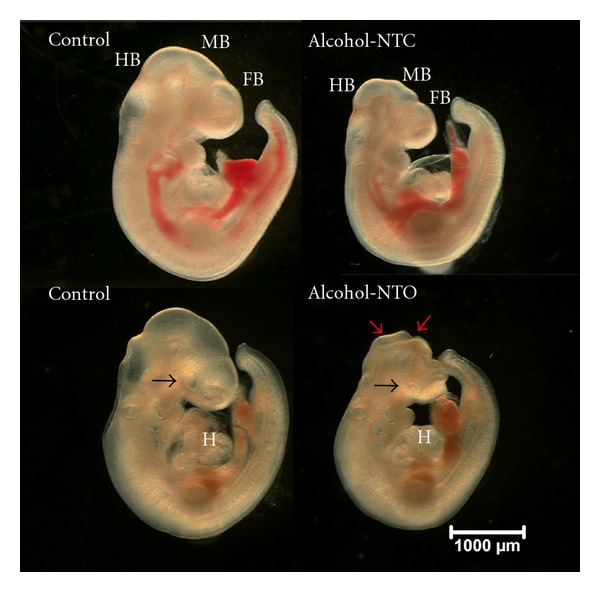 Ethanol exposure alters protein expression in a mouse model of fetal alcohol spectrum disorders.