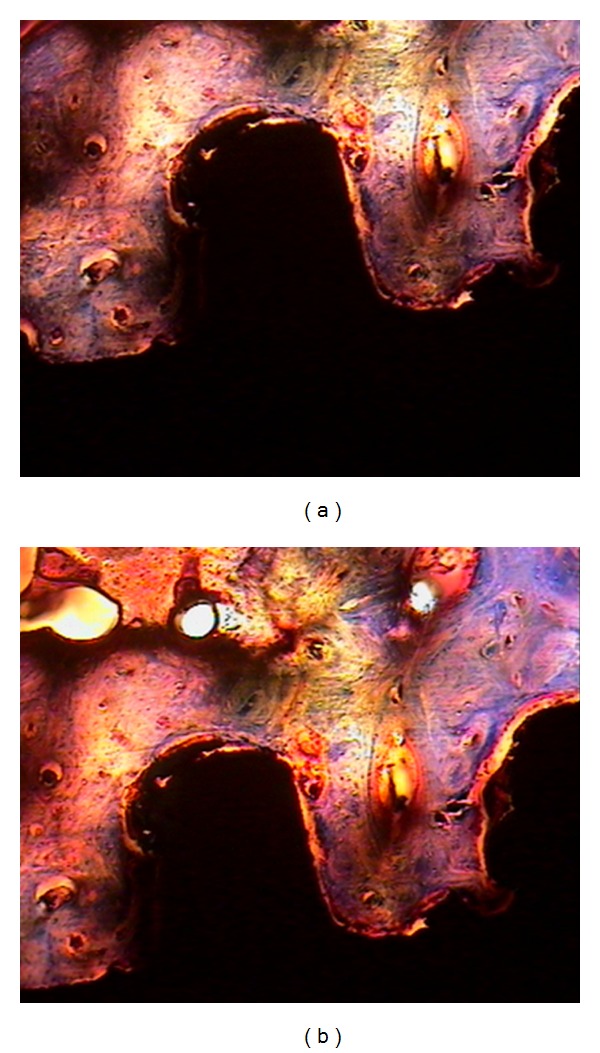 Comparative evaluation of two types of immediately loaded implants using biomechanical and histomorphometric tests: an animal case study.