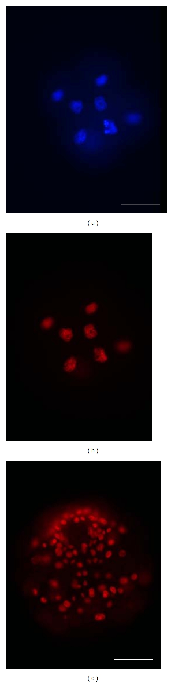 Ontogenetic survey of histone modifications in an annelid.