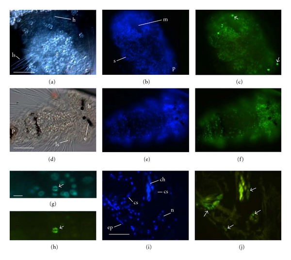 Ontogenetic survey of histone modifications in an annelid.