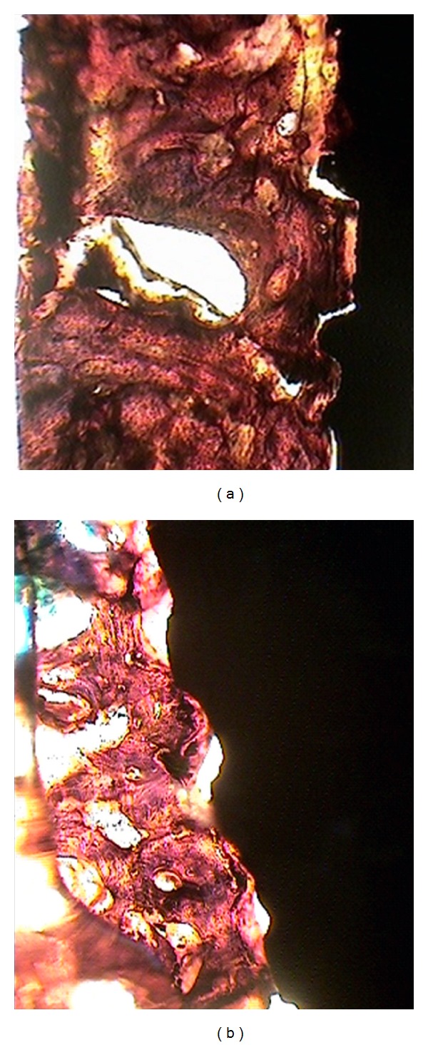 Comparative evaluation of two types of immediately loaded implants using biomechanical and histomorphometric tests: an animal case study.