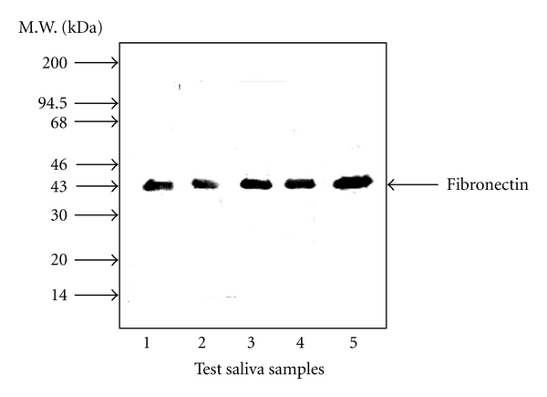 Porphyromonas gingivalis Fimbria-Induced Expression of Inflammatory Cytokines and Cyclooxygenase-2 in Mouse Macrophages and Its Inhibition by the Bioactive Compounds Fibronectin and Melatonin.