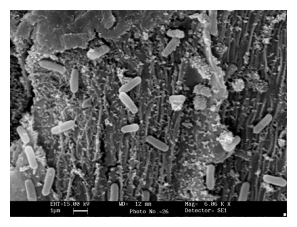 Biotechnological Potential of Agro Residues for Economical Production of Thermoalkali-Stable Pectinase by Bacillus pumilus dcsr1 by Solid-State Fermentation and Its Efficacy in the Treatment of Ramie Fibres.