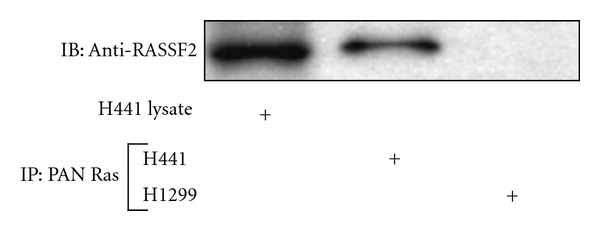 Loss of RASSF2 Enhances Tumorigencity of Lung Cancer Cells and Confers Resistance to Chemotherapy.