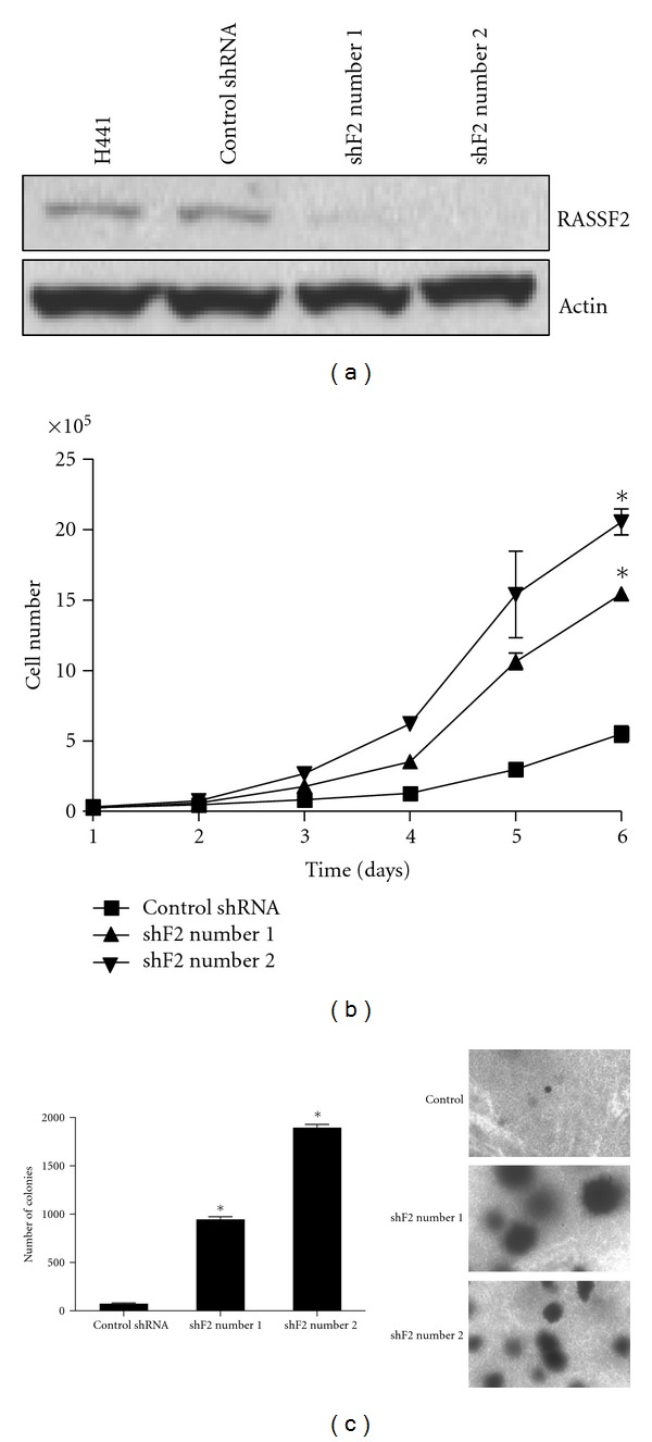 Loss of RASSF2 Enhances Tumorigencity of Lung Cancer Cells and Confers Resistance to Chemotherapy.