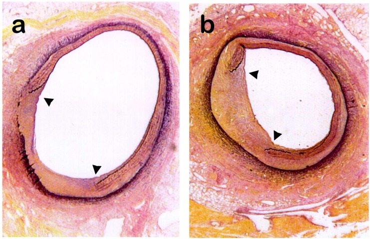 Suppression of neointimal hyperplasia following angioplasty-induced vascular injury in pigs infected with swinepox virus.