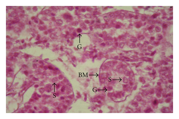 Changes in the Seminiferous Epithelium of the Testes during Postnatal Development in Assam Goat.