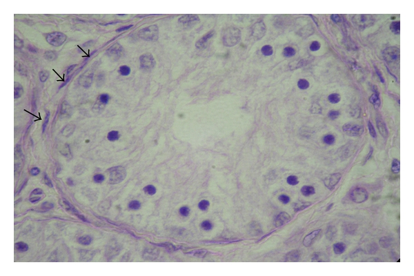Changes in the Seminiferous Epithelium of the Testes during Postnatal Development in Assam Goat.