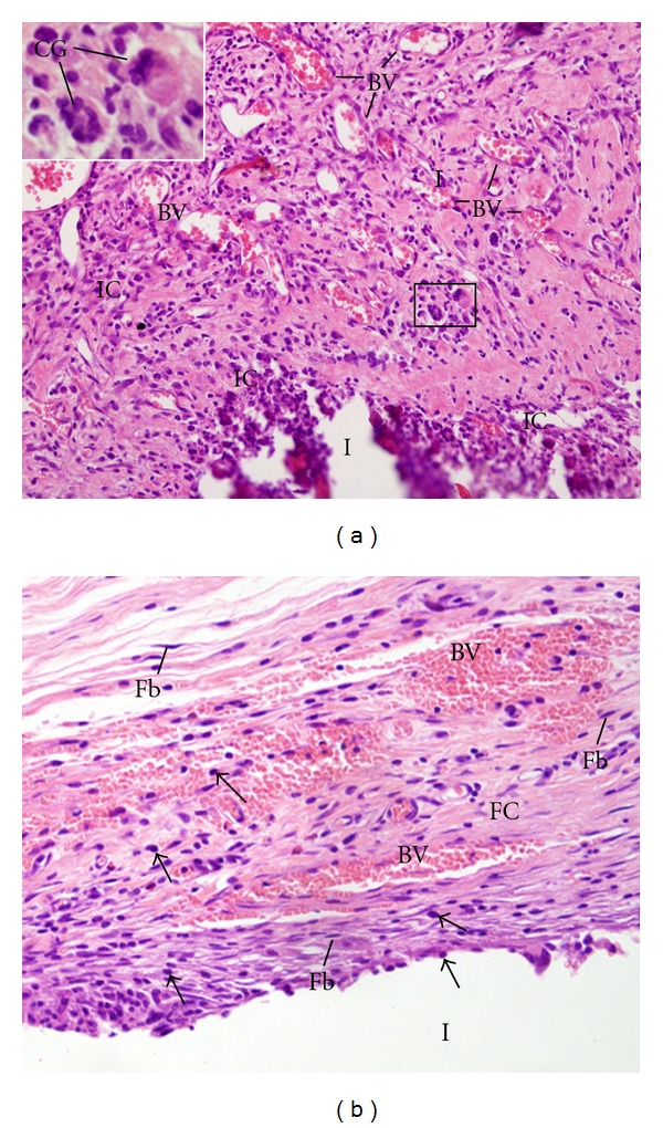 Biocompatibility of intracanal medications based on calcium hydroxide.