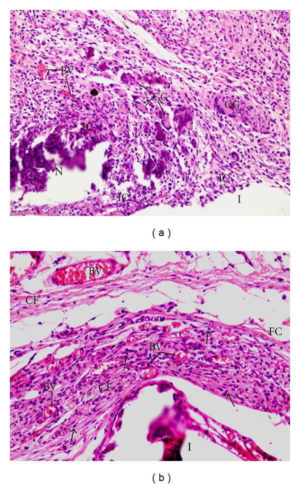 Biocompatibility of intracanal medications based on calcium hydroxide.