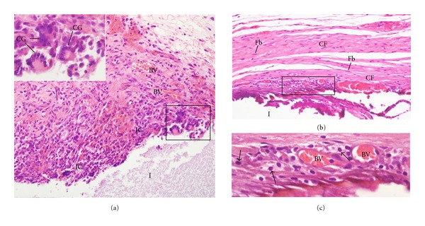 Biocompatibility of intracanal medications based on calcium hydroxide.