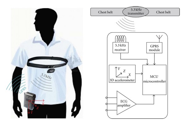 Clinical evaluation of a mobile heart rhythm telemonitoring system.