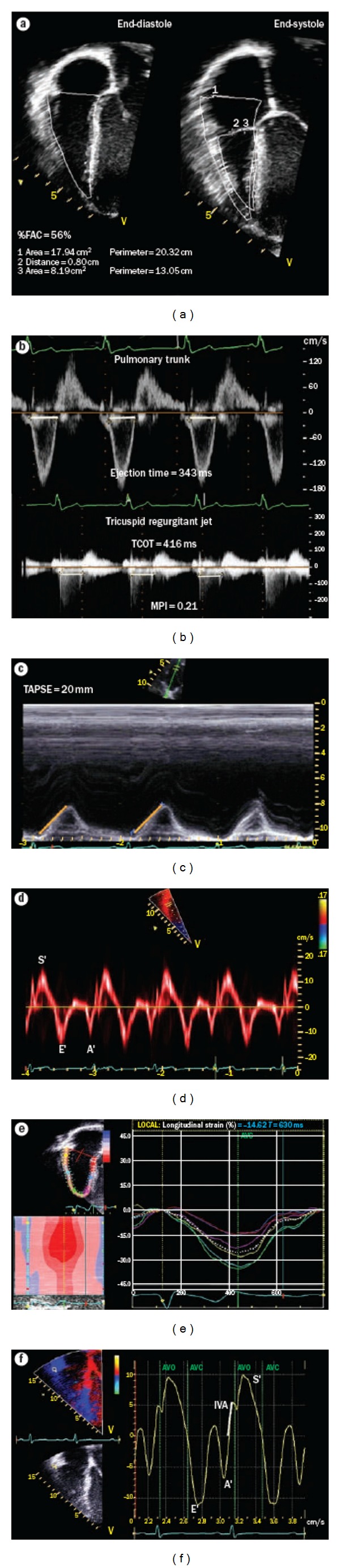 Transthoracic echocardiography in children and young adults with congenital heart disease.