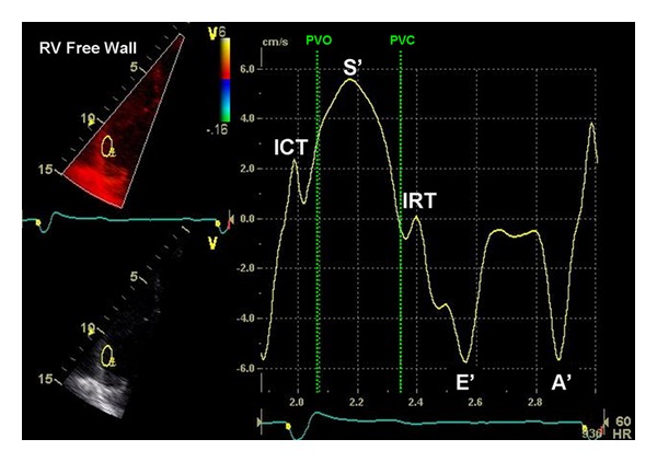 Transthoracic echocardiography in children and young adults with congenital heart disease.