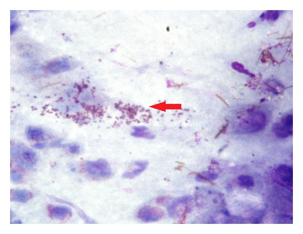 Cytological aspects on the effects of a nasal spray consisting of standardized extract of citrus lemon and essential oils in allergic rhinopathy.