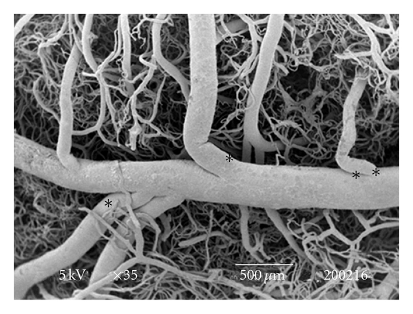 Seasonal Changes in Testes Vascularisation in the Domestic Cat (Felis domesticus): Evaluation of Microvasculature, Angiogenic Activity, and Endothelial Cell Expression.