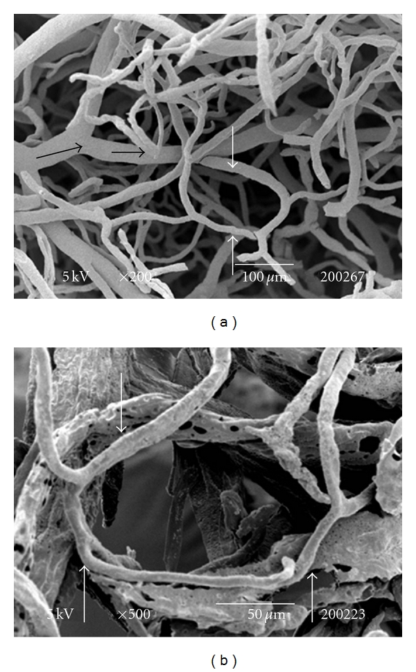 Seasonal Changes in Testes Vascularisation in the Domestic Cat (Felis domesticus): Evaluation of Microvasculature, Angiogenic Activity, and Endothelial Cell Expression.