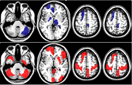 Combining graph and machine learning methods to analyze differences in functional connectivity across sex.