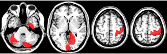 Combining graph and machine learning methods to analyze differences in functional connectivity across sex.