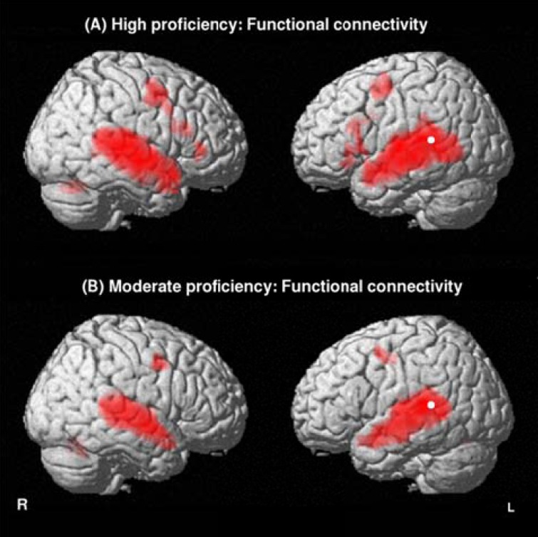 The neural processing of second language comprehension modulated by the degree of proficiency: a listening connected speech FMRI study.