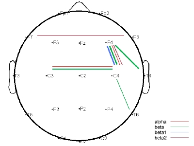 The influence of dopamine receptor d4 polymorphism on resting EEG in healthy young females.