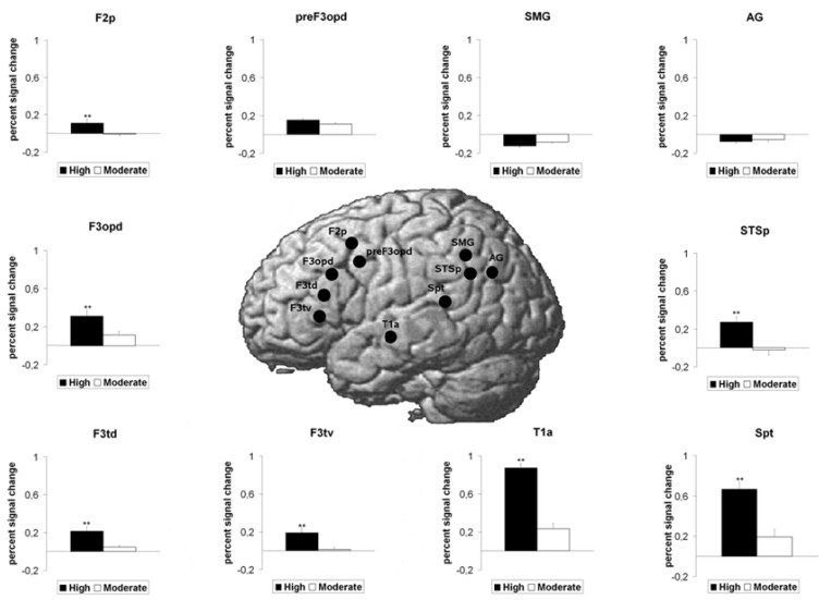 The neural processing of second language comprehension modulated by the degree of proficiency: a listening connected speech FMRI study.