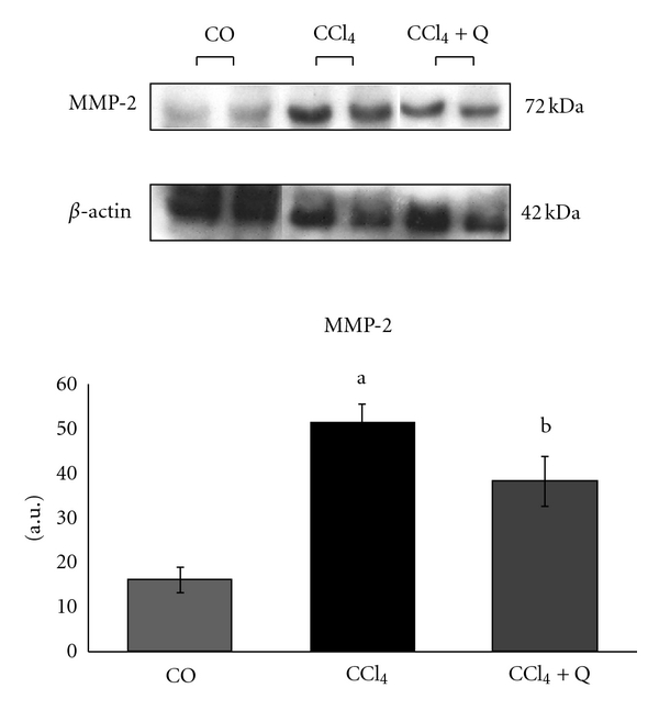 Effect of antioxidant treatment on fibrogenesis in rats with carbon tetrachloride-induced cirrhosis.