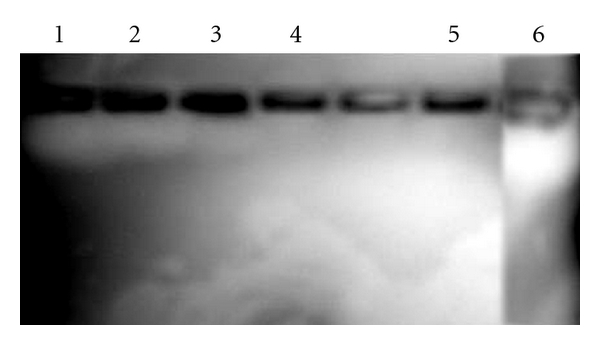 In Vitro  α-Amylase Inhibitory Activity of the Leaves of Thespesia populnea.