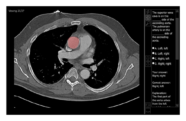 Strategic improvements for gross anatomy web-based teaching.