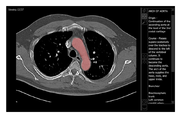 Strategic improvements for gross anatomy web-based teaching.