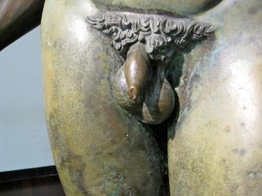 Scrotal asymmetry, varicocoele and the Riace Bronzes