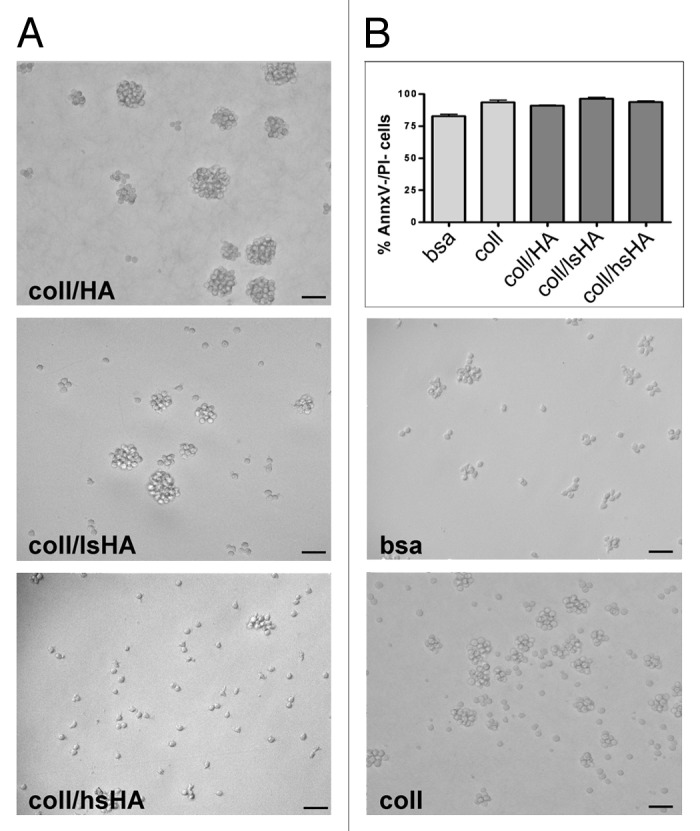 Artificial extracellular matrices composed of collagen I and high sulfated hyaluronan modulate monocyte to macrophage differentiation under conditions of sterile inflammation.