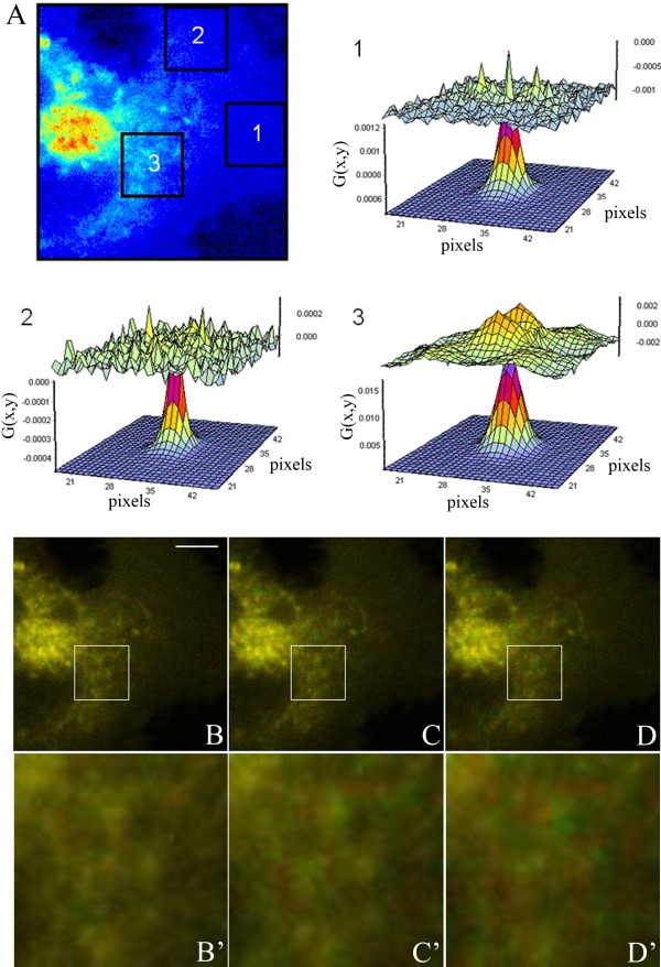 Two-photon time-lapse microscopy of BODIPY-cholesterol reveals anomalous sterol diffusion in chinese hamster ovary cells.