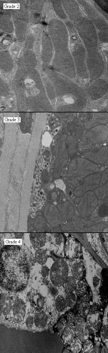 The influence of perfusion solution on renal graft viability assessment.
