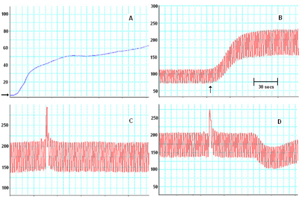 The influence of perfusion solution on renal graft viability assessment.