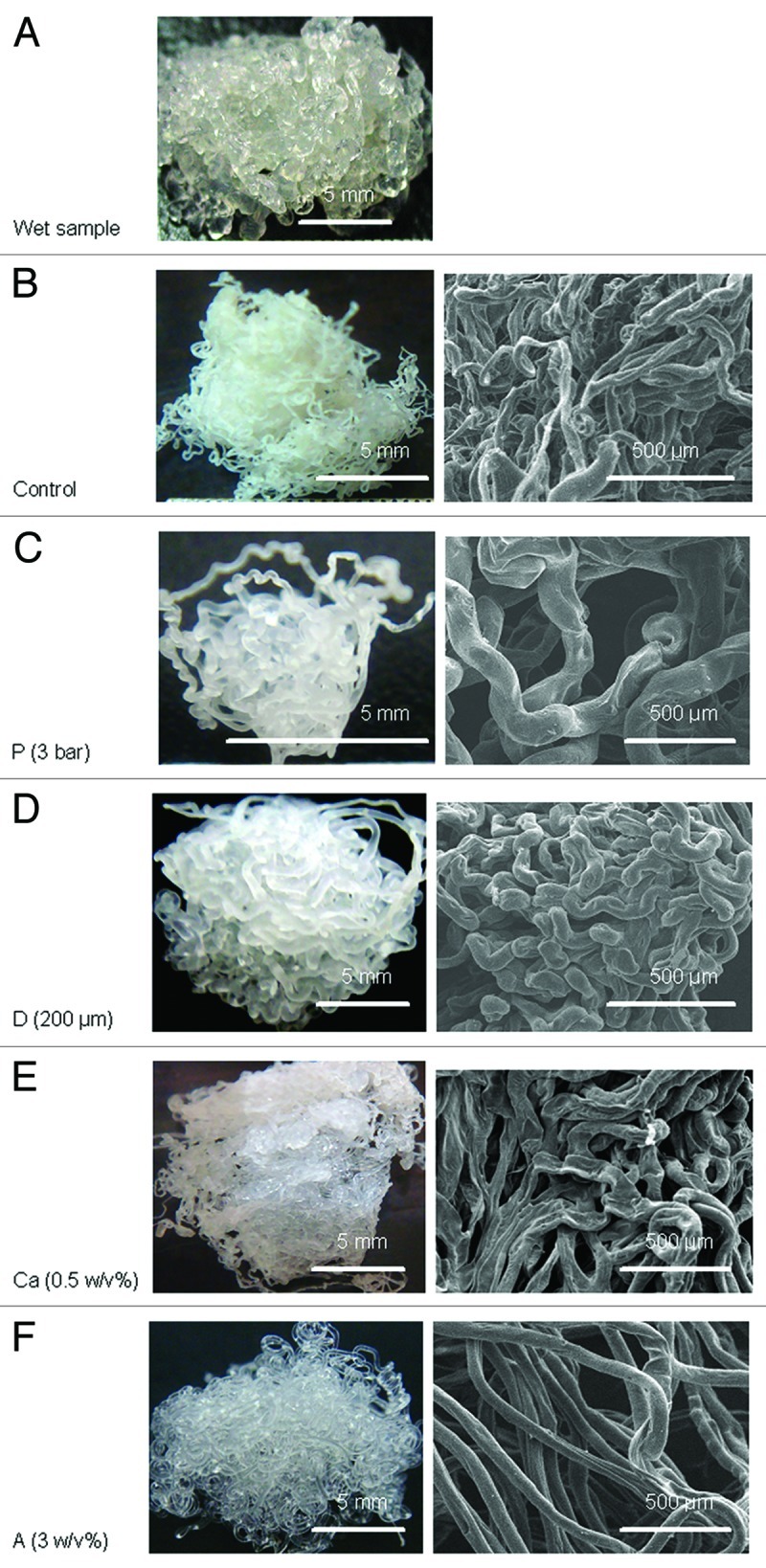 The influence of operating parameters on the drug release and antibacterial performances of alginate fibrous dressings prepared by wet spinning.