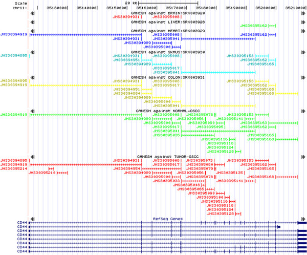 Genome-wide Profiling of RNA splicing in prostate tumor from RNA-seq data using virtual microarrays.