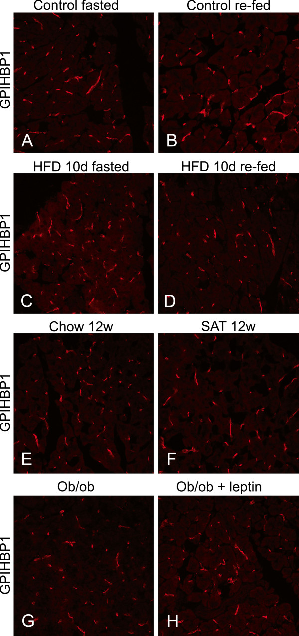 Localization of lipoprotein lipase and GPIHBP1 in mouse pancreas: effects of diet and leptin deficiency.