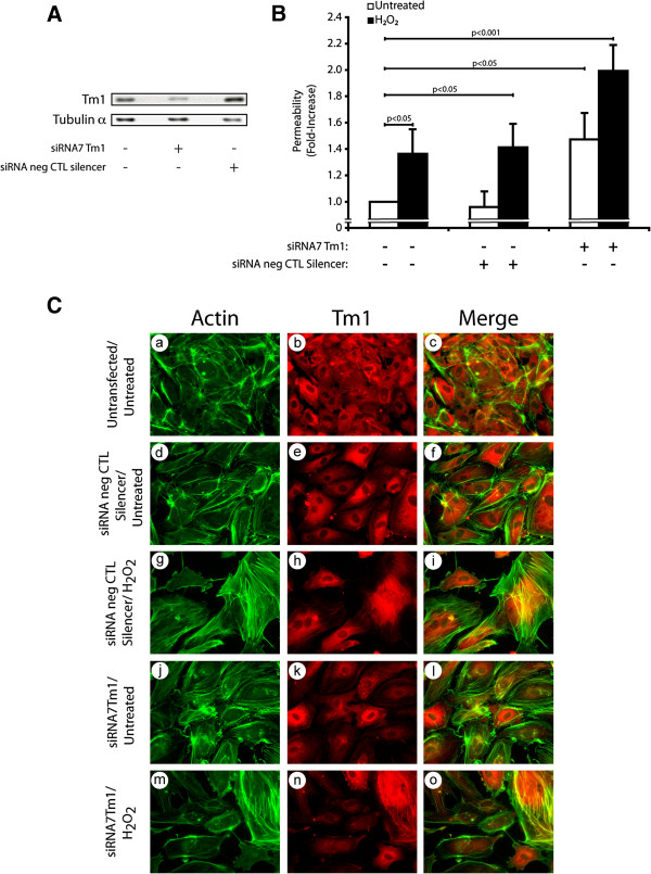 Regulation of endothelial permeability and transendothelial migration of cancer cells by tropomyosin-1 phosphorylation.