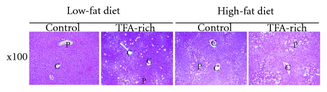 Murine Models of Nonalcoholic Fatty Liver Disease and Steatohepatitis.